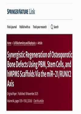Synergistic Regeneration of Osteoporotic Bone Defects Using PBM Stem Cells and hMPMS Scaffolds Via the miR 21 RUNX2 Axis