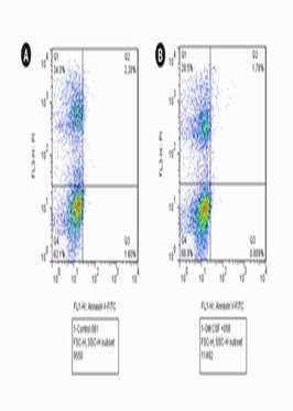 The role of GM csf factor in inducing autophagy in spermatozoa of patients with asthenoteratozoospermia